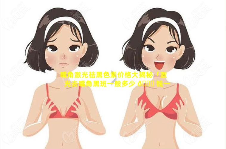 嘴角激光祛黑色素价格大揭秘「激光去嘴角黑斑一般多少 🐕 钱一个」